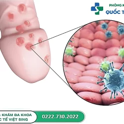 Mụn rộp sinh dục nam: dấu hiệu, biến chứng & cách chữa trị