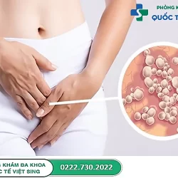 Đi tìm nguyên nhân và cách chữa bệnh mụn rộp sinh dục nữ