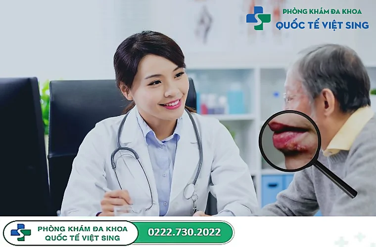 Khi nào bị mụn rộp cần gặp bác sĩ?