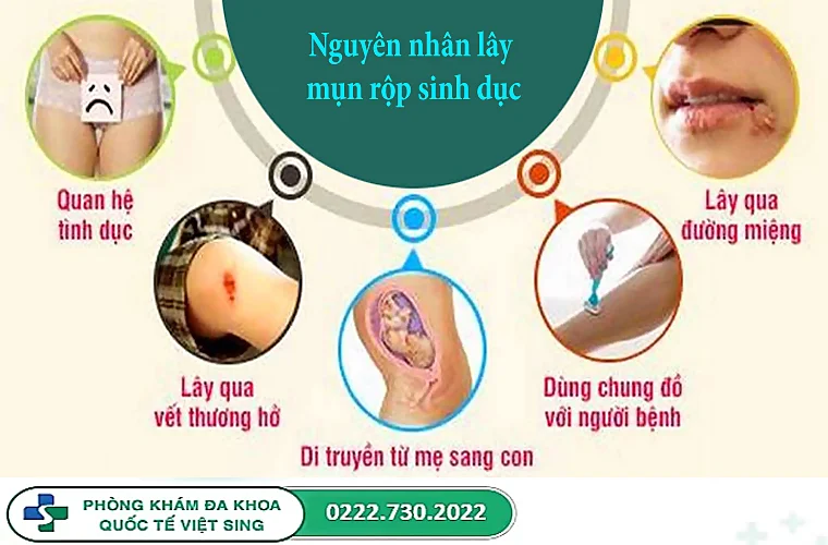 Mụn rộp sinh dục là gì? Nguyên nhân lây nhiễm bệnh