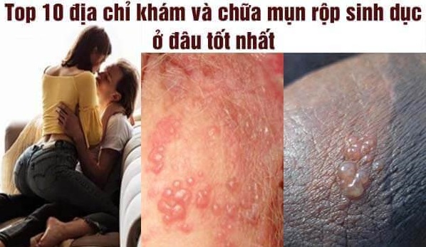 Địa chỉ phòng khám chữa viêm bao quy đầu Bắc Ninh: Top 10 lựa chọn uy tín