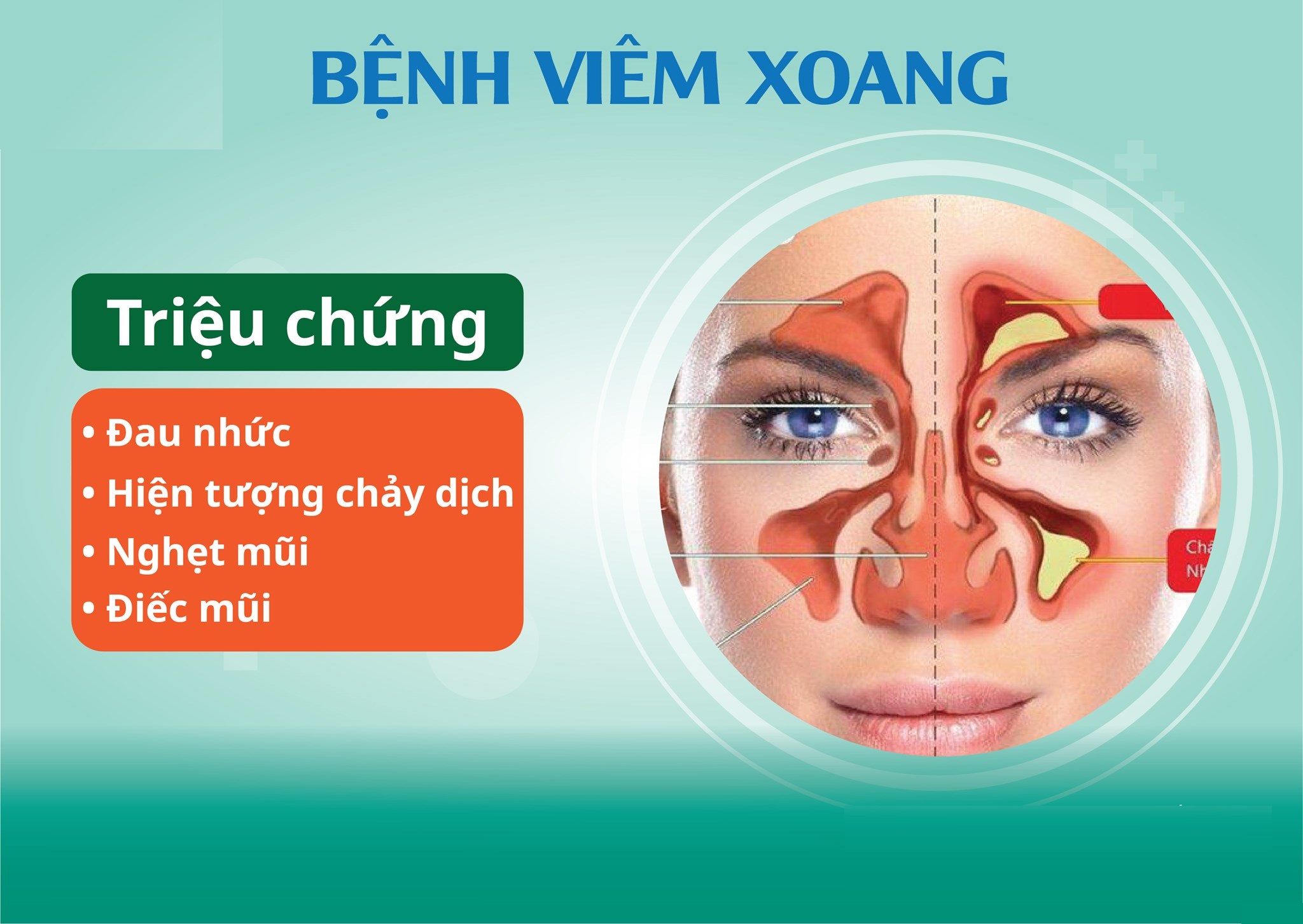 Top 10 địa chỉ phòng khám chữa viêm xoang Bắc Ninh uy tín, hiệu quả