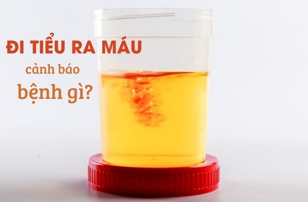 Top 10 địa chỉ phòng khám chữa tiểu ra máu Bắc Ninh