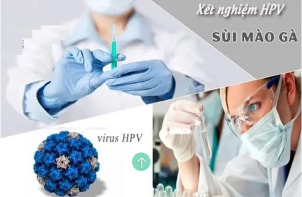 Bật mí 10+ địa chỉ Phòng khám Xét nghiệm sùi mào gà Bắc Ninh an toàn, kết quả nhanh chóng