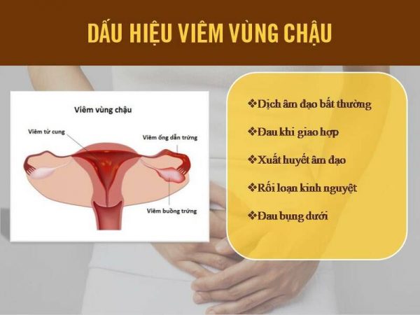 Địa chỉ khám chữa viêm vùng chậu Bắc Ninh uy tín, hiệu quả