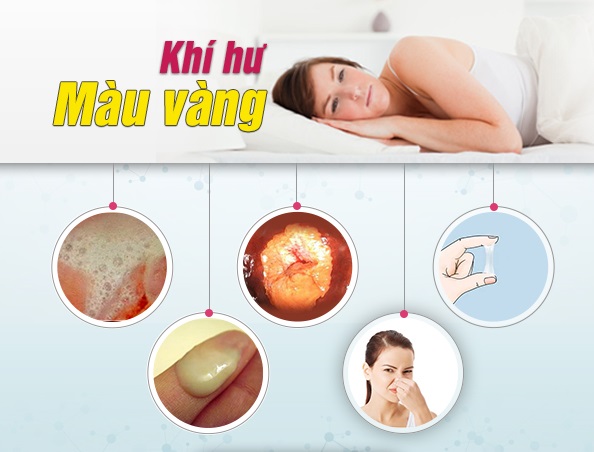 Đừng xem nhẹ khí hư màu vàng – Gợi ý địa chỉ khám khí hư màu vàng Bắc Ninh được nhiều chị em tin chọn