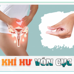 Khí hư vón cục là gì? Khám khí hư vón cục Bắc Ninh giúp bạn an tâm