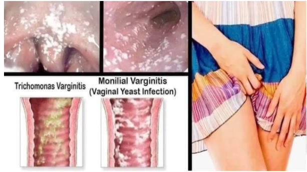 Khám chữa nấm phụ khoa Bắc Ninh: Bí mật sức khỏe vùng kín mà 90% chị em đang bỏ qua