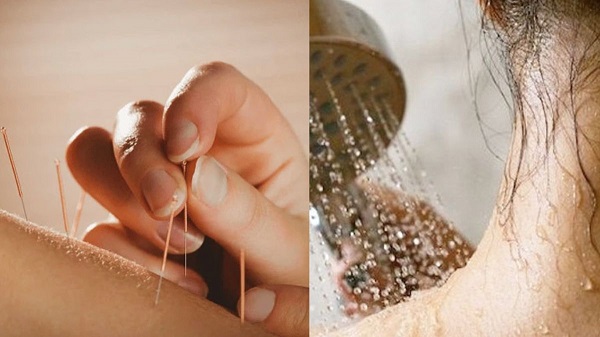 Bác sĩ giải đáp: Châm cứu xong có tắm được không? Bao lâu thì tắm được?